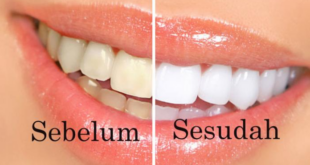 Cara Memutihkan Gigi Menggunakan Kulit Jeruk
